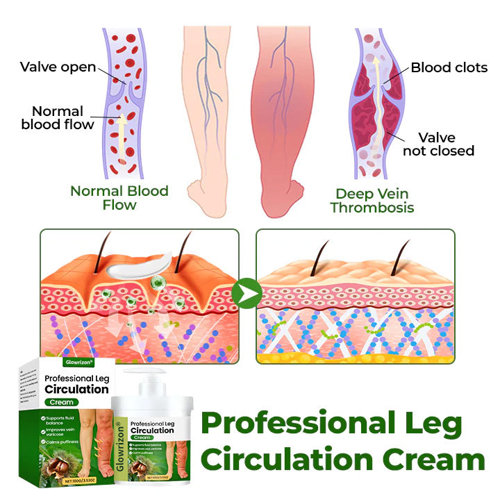 Glowrizon® Circulation Boost Cream – Clinically proven relief for swollen, heavy, painful legs.