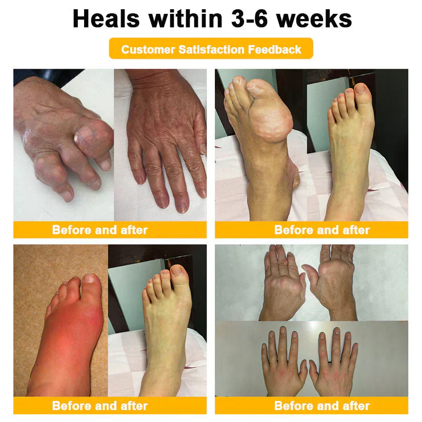 (🔥Limited Time Discount Last Day）AQA™ Botulinum & Bee Essence Pain Relief Bone Healing Cream