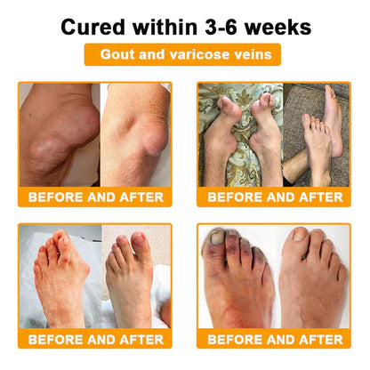 (🔥Limited Time Discount Last Day）AQA™ Botulinum & Bee Essence Pain Relief Bone Healing Cream