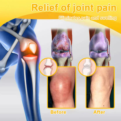 (🔥Limited Time Discount Last Day）AQA™ Botulinum & Bee Essence Pain Relief Bone Healing Cream