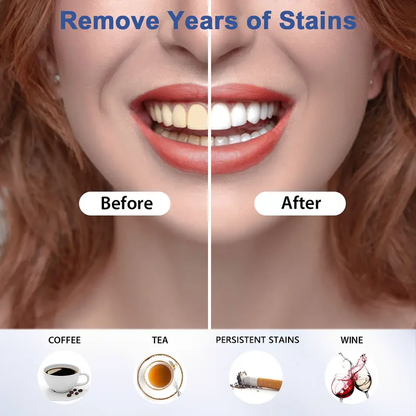 🦷SmileFitPro 35%CP Teeth Whitening Pen (30+ Treatment - Mint Flavor, Enamel Safe, Dentist Formulated, 10 Min Fast Whitening)