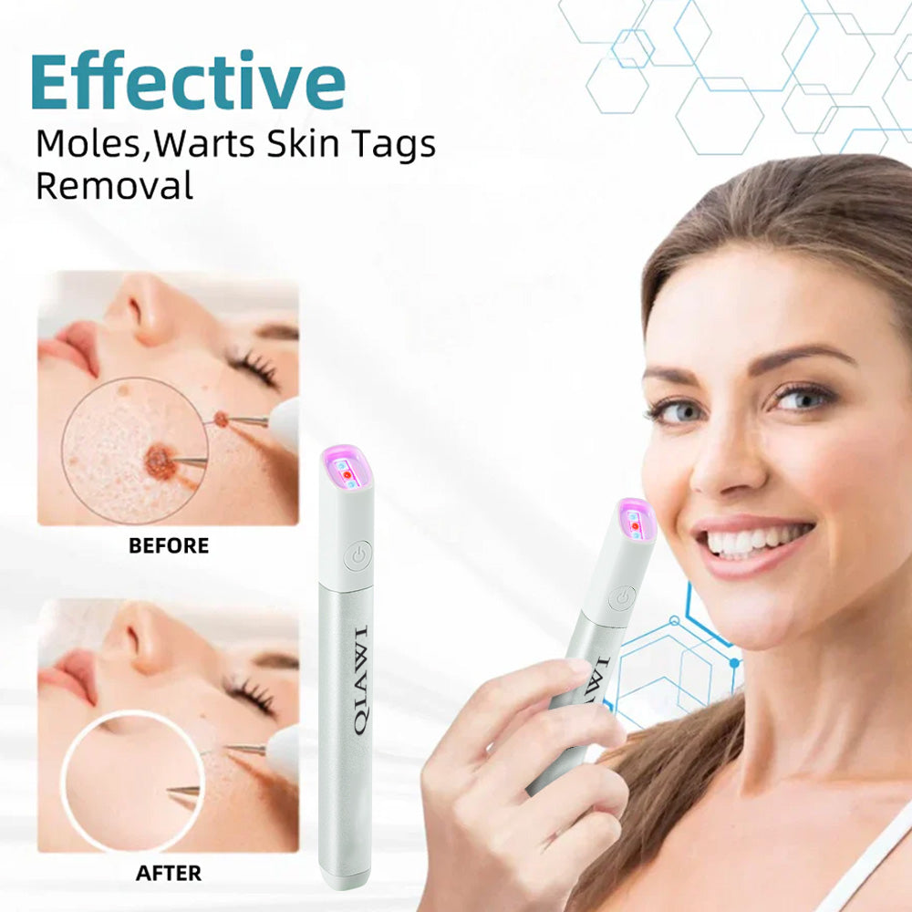 QIAWI™ All-in-One CO₂ Laser Eraser Pen | Removes Moles, Warts, Skin Flaws & Pigmentation
