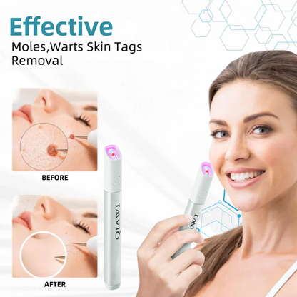 QIAWI™ All-in-One CO₂ Laser Eraser Pen | Removes Moles, Warts, Skin Flaws & Pigmentation