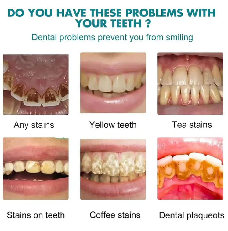 Final3 Hours: 33 %OFF——Tooth Polish - Instant White Smile