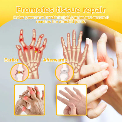 (🔥Limited Time Discount Last Day）AQA™ Botulinum & Bee Essence Pain Relief Bone Healing Cream