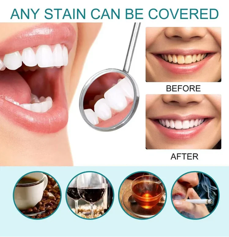 Final3 Hours: 33 %OFF——Tooth Polish - Instant White Smile