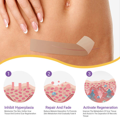 ✅Official Store | BBOJI® Hyaluronan Nano Microneedle Repair Tape🏥(Treatment of old and new scars, reduction of surgical scars, stretch marks, keloids, acne, burns, warts, dermatomes and varicose veins)★