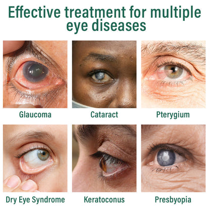 Lovilds® Nano Eye Drops Serum 👩‍⚕️ Royal College of Ophthalmologists Recommended (Suitable for presbyopia, dry eye syndrome, glaucoma, and cataracts)