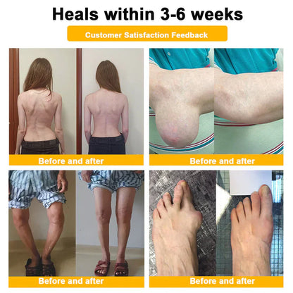 (🔥Limited Time Discount Last Day）AQA™ Botulinum & Bee Essence Pain Relief Bone Healing Cream