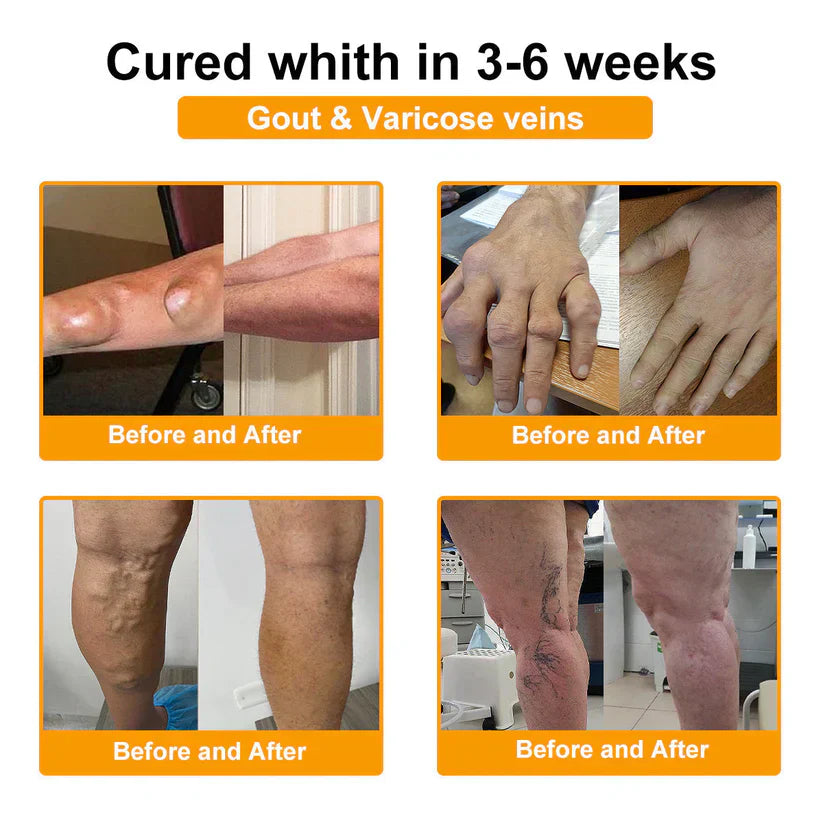 (🔥Limited Time Discount Last Day）AQA™ Botulinum & Bee Essence Pain Relief Bone Healing Cream