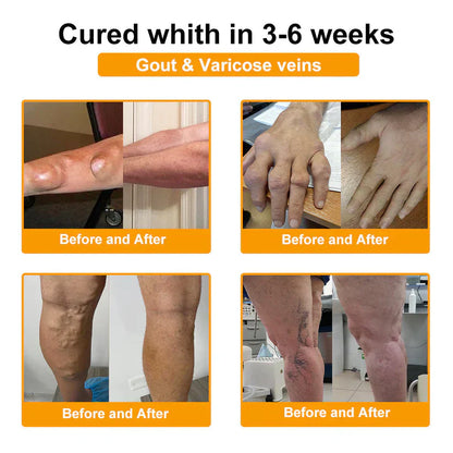 (🔥Limited Time Discount Last Day）AQA™ Botulinum & Bee Essence Pain Relief Bone Healing Cream