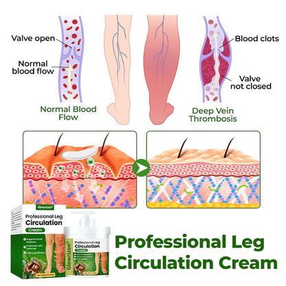 Glowrizon® Circulation Boost Cream – Clinically proven relief for swollen, heavy, painful legs.
