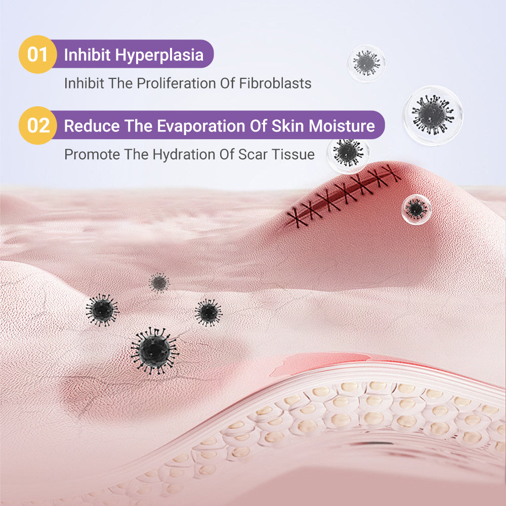 ✅Official Store | BBOJI® Hyaluronan Nano Microneedle Repair Tape🏥(Treatment of old and new scars, reduction of surgical scars, stretch marks, keloids, acne, burns, warts, dermatomes and varicose veins)★